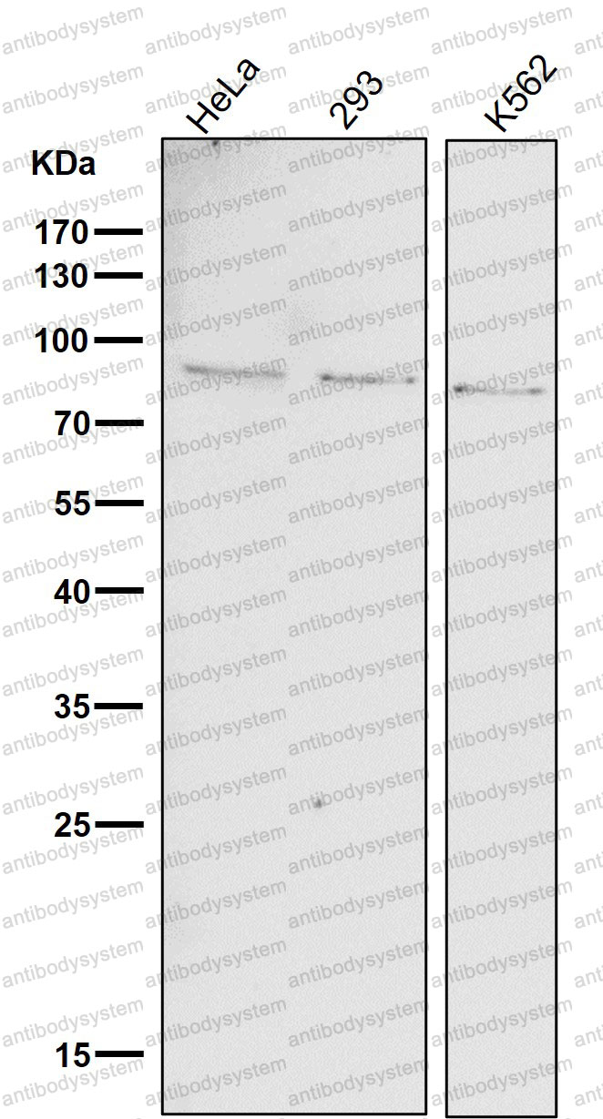 Anti-Phospho-STAT1 (Y701) Antibody (R1V99)