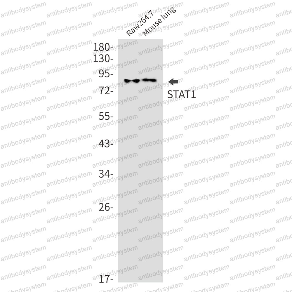 Anti-STAT1 Antibody (R1W03)