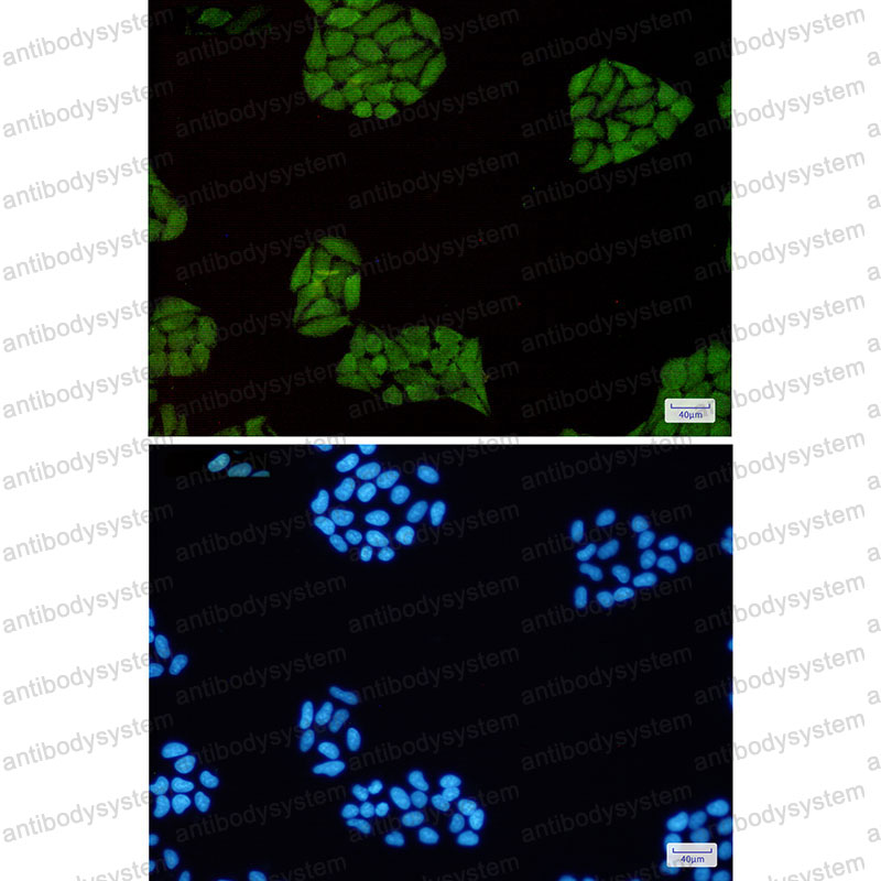 Anti-STAT1 Antibody (R1W02)