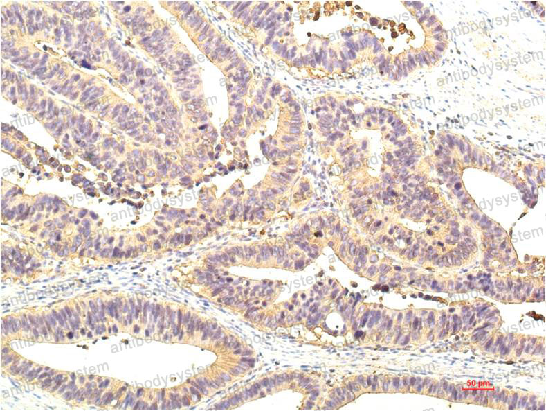 Anti-STAT1 Antibody (R3K68)