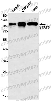 Anti-STAT6 Antibody (R1W04)