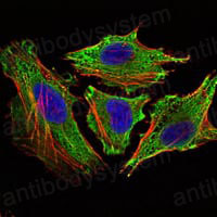 Anti-STAT6 Antibody (R3K69)