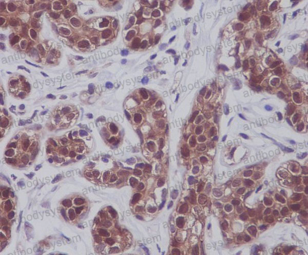 Anti-STAT5A/B Antibody (R1W05)