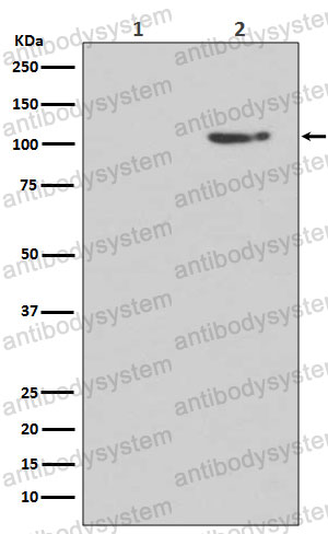 Anti-Phospho-GRIA1/GluR-1 (S845) Antibody (R1W07)
