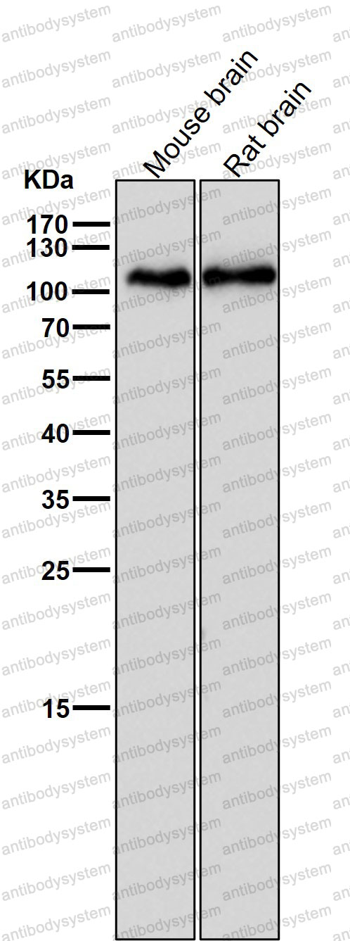 Anti-GRIA1/GluR-1 Antibody (R1W08)
