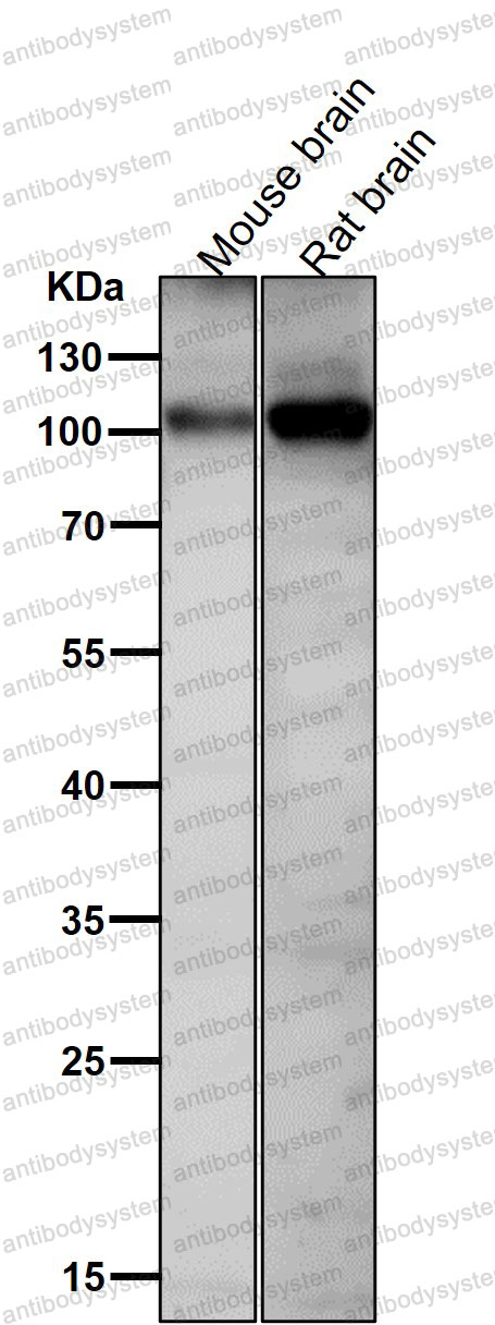 Anti-Phospho-GRIA1/GluR-1 (S831) Antibody (R1W09)