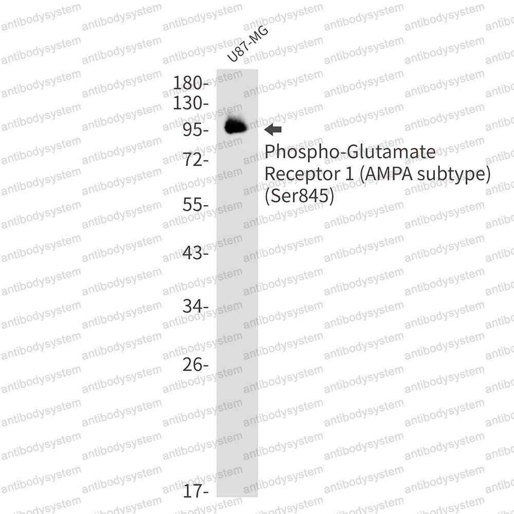 Anti-Phospho-GRIA1/GluR-1 (Ser845) Antibody (R1W10)