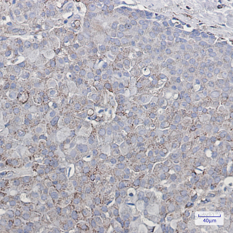 Anti-GRIA2/GluR-2 Antibody (R1W12)