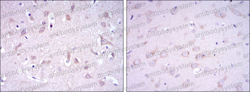 Anti-GRIA3 Antibody (R3K75)