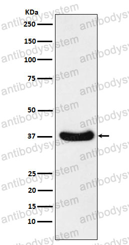 Anti-AKR1C3 Antibody (R1W13)