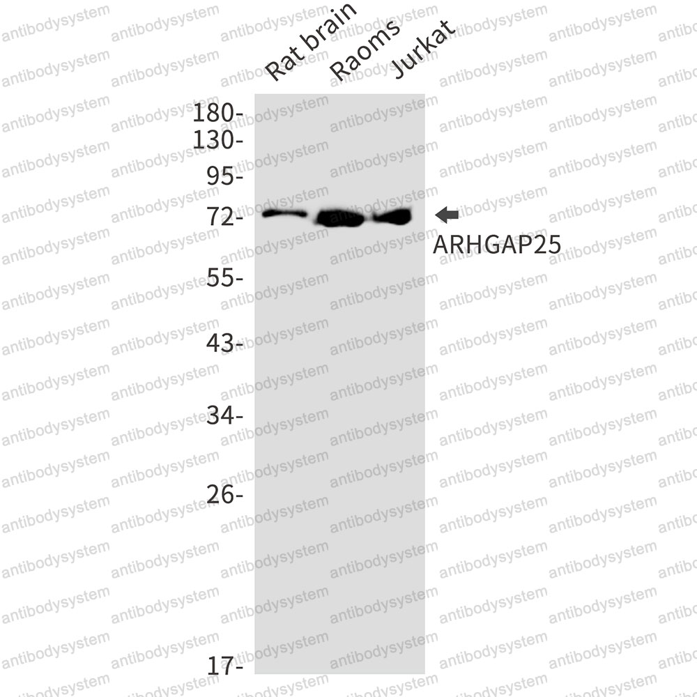 Anti-ARHGAP25 Antibody (R1W14)