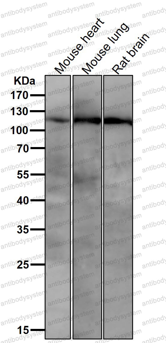 Anti-PIK3CB/p110beta Antibody (R1A73)