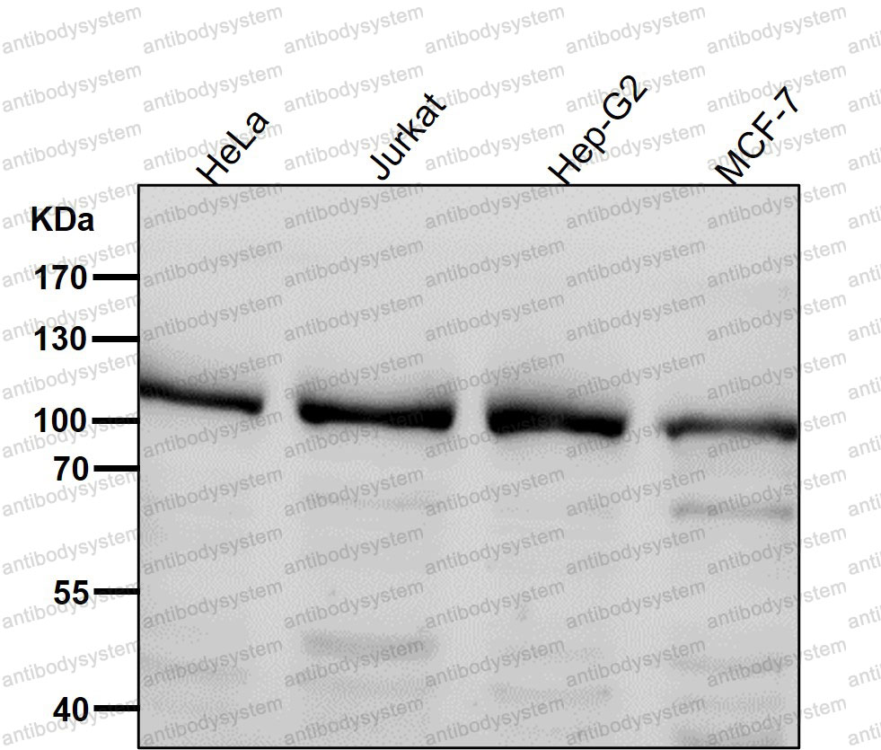 Anti-PIK3CB/p110beta Antibody (R1W15)