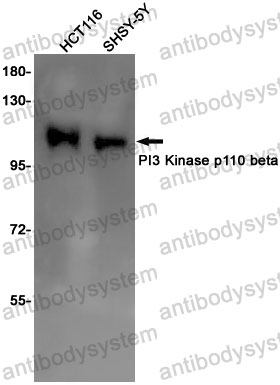 Anti-PIK3CB/p110beta Antibody (R1W16)