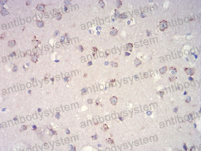 Anti-MTOR Antibody (R3K77)
