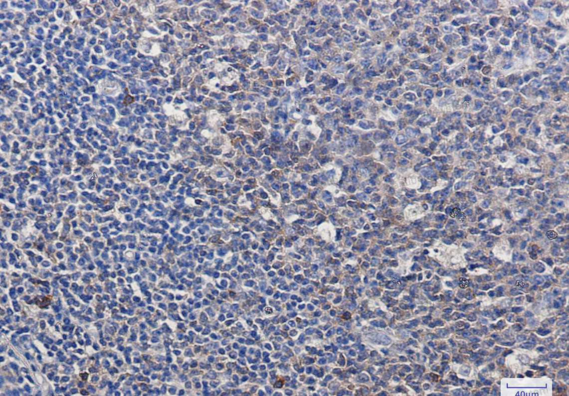 Anti-CASP3/Caspase-3 Antibody (R1W20)