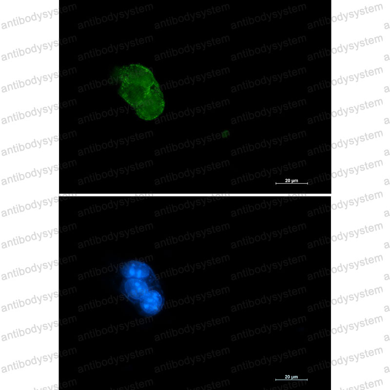 Anti-CASP3/Caspase-3 Antibody (R1W21)