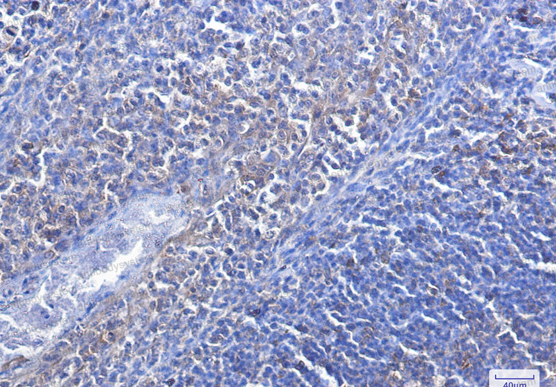 Anti-CASP3/Caspase-3 Antibody (R1W22)