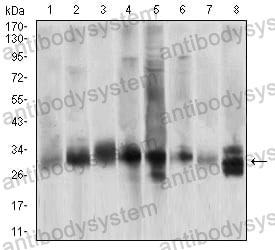 Anti-CASP3/Caspase-3 Antibody (R3K78)