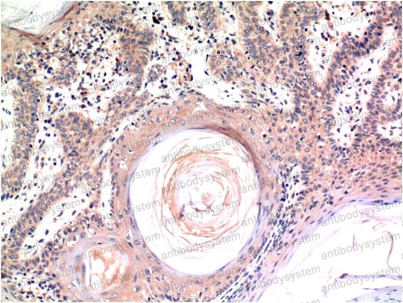 Anti-CASP3/Caspase-3 Antibody (R3K80)