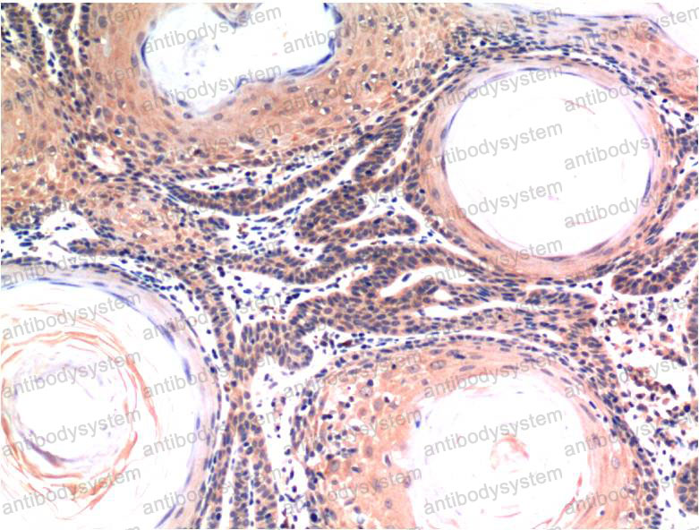 Anti-CASP3/Caspase-3 Antibody (R3K81)