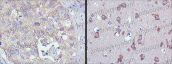 Anti-RPS27 Antibody (R3K82)