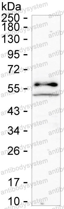 Anti-TXK Antibody (R3K85)