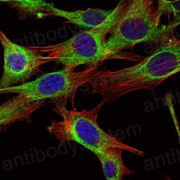 Anti-ABL2 Antibody (R3K87)