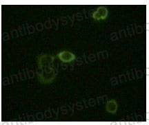 Anti-ABL2 Antibody (R3K86)