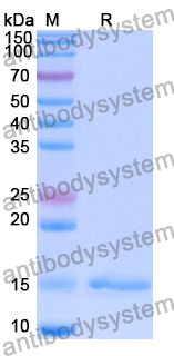 Anti-Human CD212/IL12RB1 Nanobody (SAA1300)