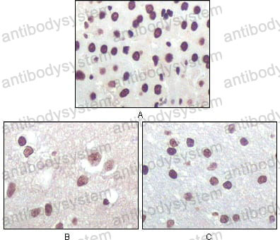 Anti-CDKN2A/p16INK4a Antibody (R3K92)
