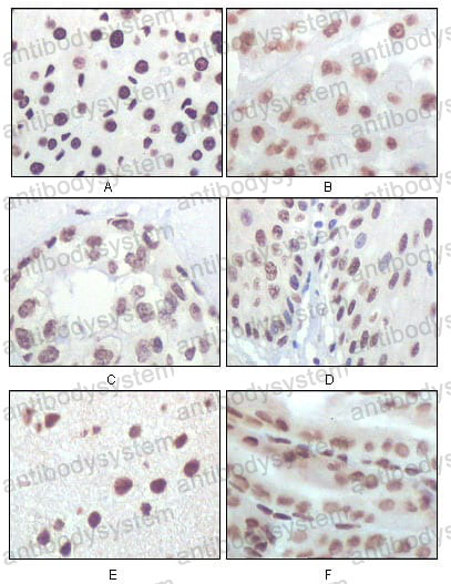 Anti-CDKN2A/p16INK4a Antibody (R3K93)