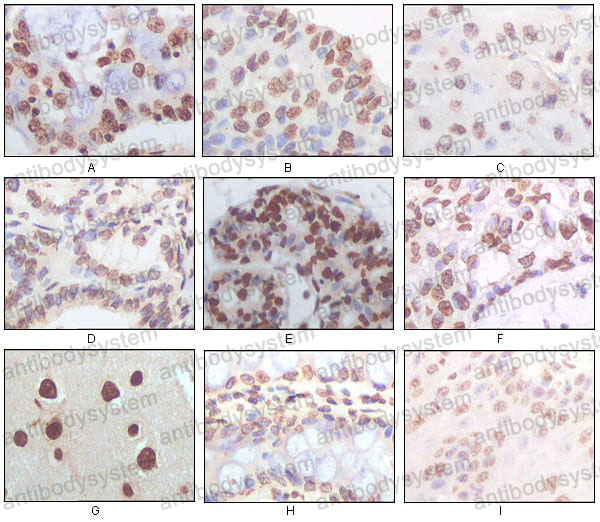 Anti-CDKN2A/p16INK4a Antibody (R3K94)