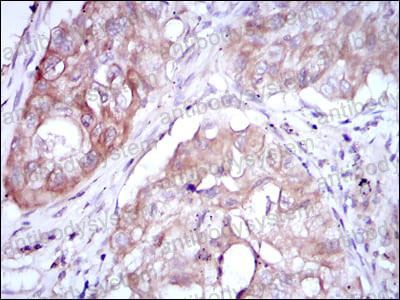 Anti-MTHFR Antibody (R3K99)