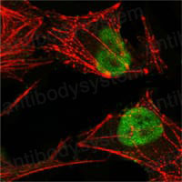 Anti-MSH2 Antibody (R3L03)