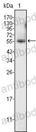 Anti-ETV4 Antibody (R3L09)