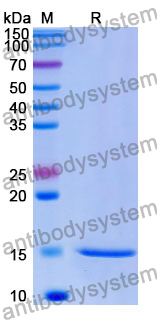 Anti-Human MAGEB1 Nanobody (SAA1034)