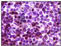 Anti-ZAP70 Antibody (R3L15)