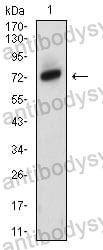 Anti-ZAP70 Antibody (R3L16)