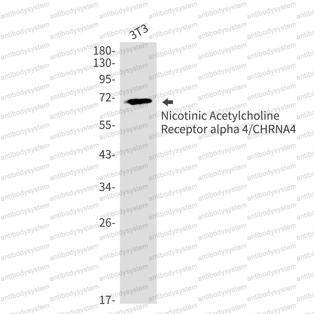 Anti-CHRNA4 Antibody (R1W54)