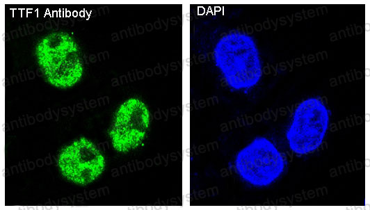 Anti-NKX2-1/TTF1 Antibody (R1B12)