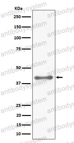 Anti-NKX2-1 Antibody (R1W56)