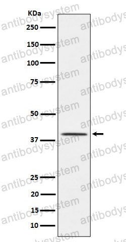 Anti-NKX2-1 Antibody (R1W55)