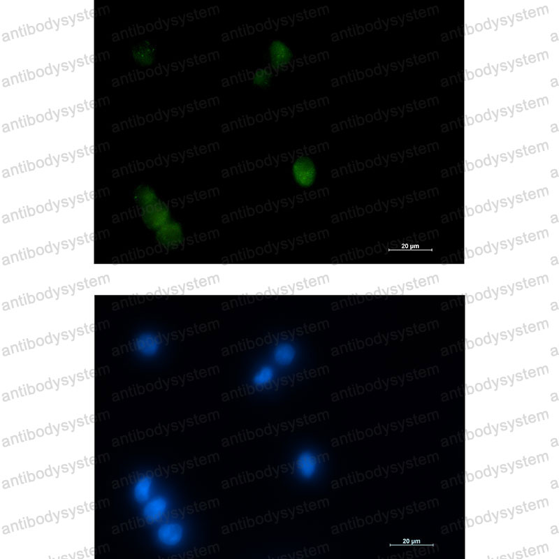 Anti-NKX2-1 Antibody (R1W57)