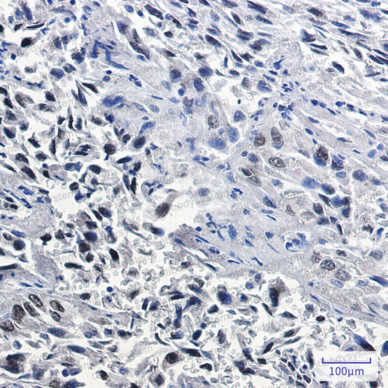 Anti-NKX2-1 Antibody (R1W58)