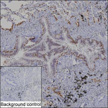 Anti-NKX2-1 Antibody (R3L29)