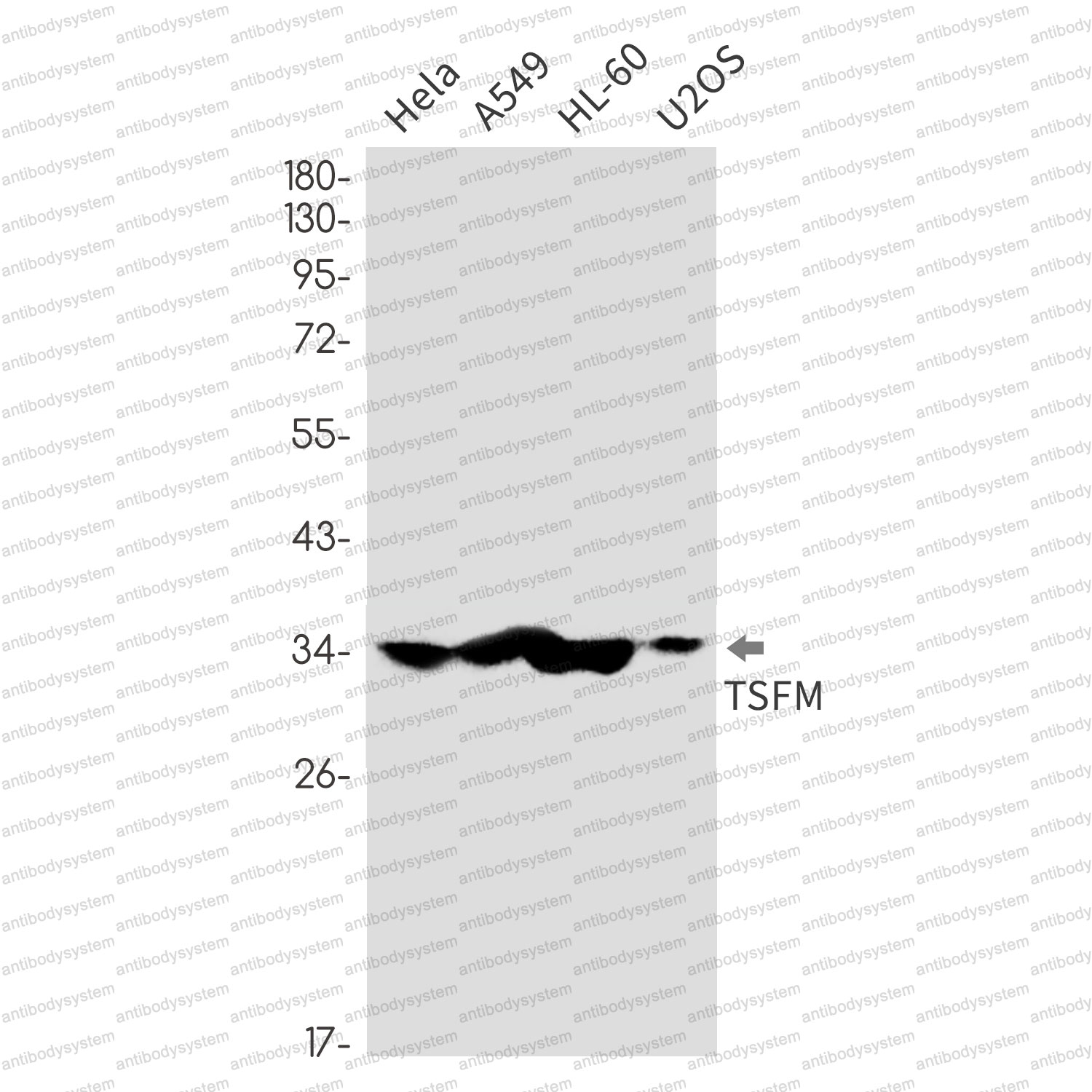 Anti-TSFM Antibody (R1W60)