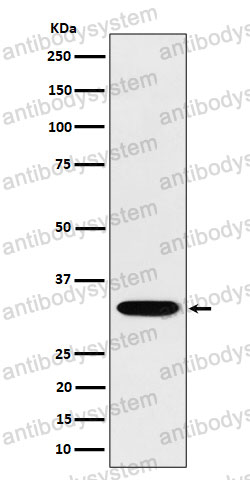 Anti-TSFM Antibody (R1W59)