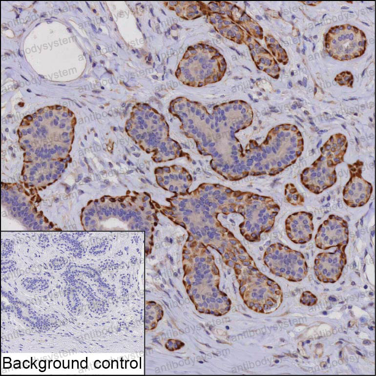 Anti-MMP13 Antibody (R3L33)