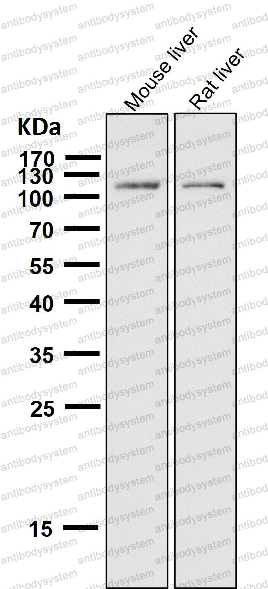 Anti-ABCG1 Antibody (R1B43)